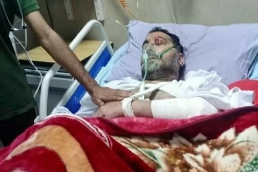 سیکریٹری جنرل ایم ڈبلیوایم آزادجموں کشمیر علامہ تصورنقوی کی گاڑی کو حادثہ ، شدید زخمی حالت میں اسپتال منتقل،دعاؤں کی اپیل